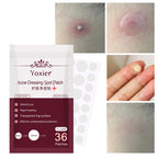 Cuvante clear pimple patches for discreet blemish care