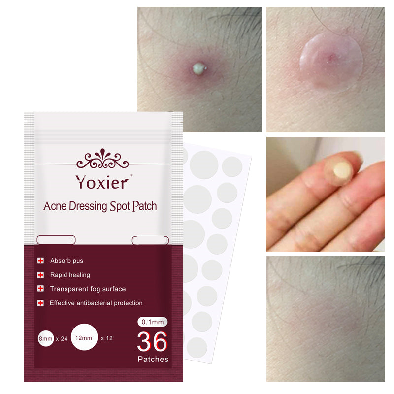 Cuvante clear pimple patches for everyday daytime wear