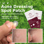 Cuvante invisible pimple patches in a skincare routine